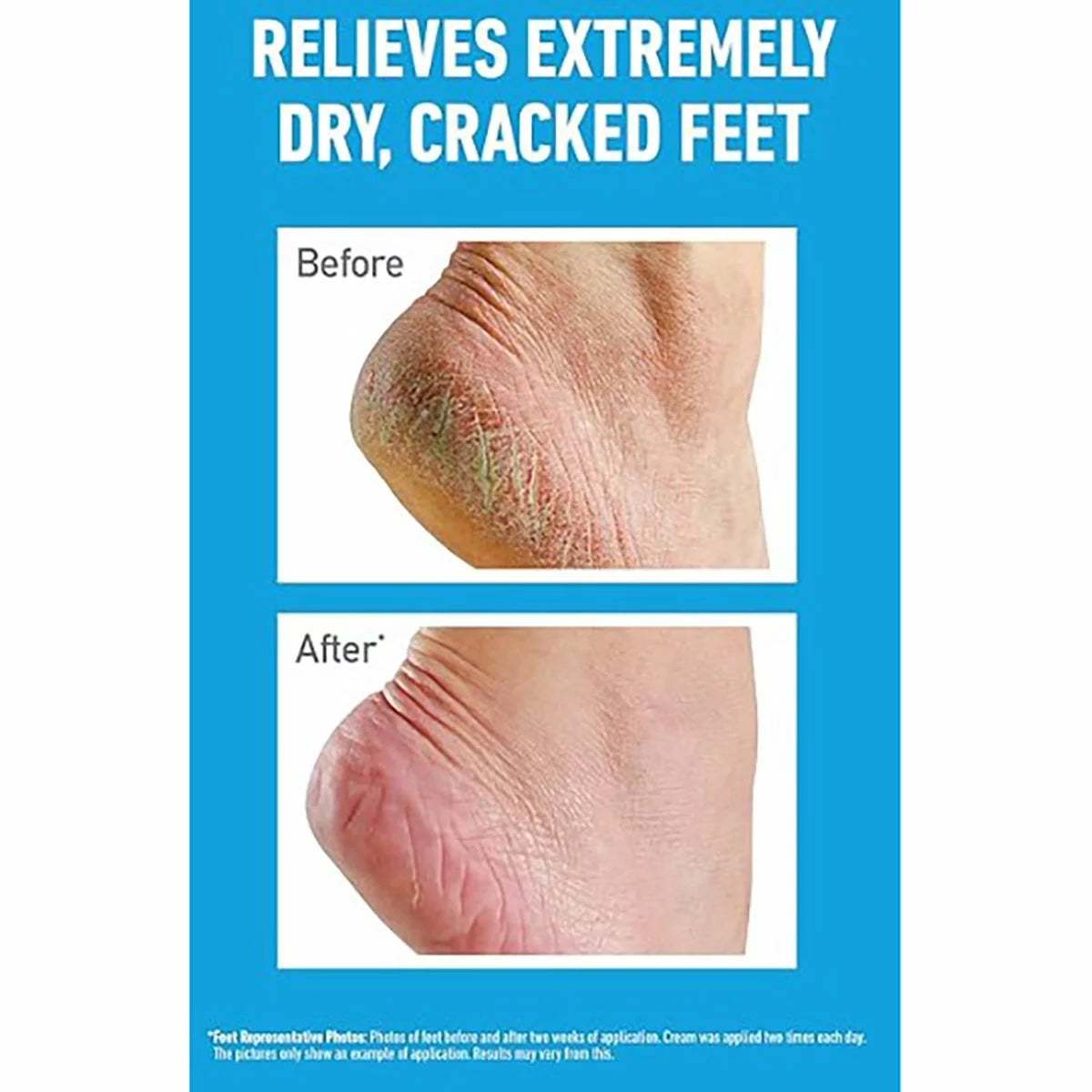 O'Keeffe's Healthy Feet Original, 2 x 180ml